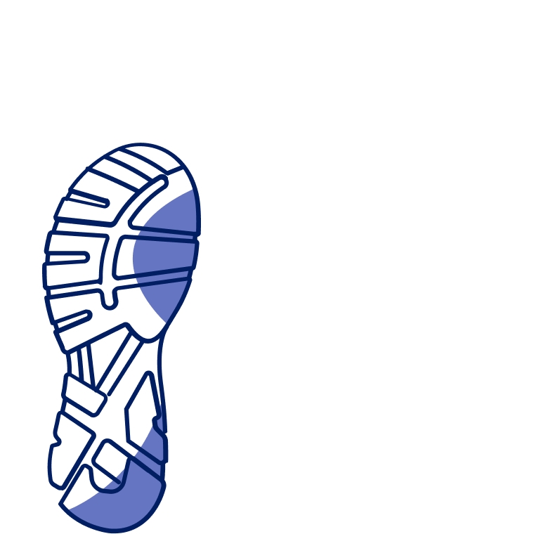 Overpronation: Needs shoes with structured support or cushioning.