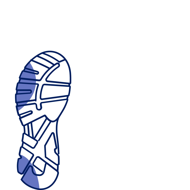 Underpronation: Needs extra cushioning to absorb impact.