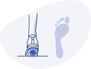 What is a Neutral Foot Type? Ground Contact: When landing, the outside of your heel lands first and rolls inward. Push-Off: Pressure is evenly distributed from the front of your foot. Foot Type: Neutral. Potential Injuries: Injuries are less likely but neutral runners are not immune to injury. Recommended Shoes: Most shoes are suitable.